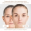 4EMS МИКРОТОК ЛИФТИНГ-МАССАЖЕР MEDICA+ SKIN LIFTING 6.0 Pink гарантия 1 год 11
