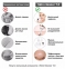 Вакуумный очиститель кожи и пор MEDICA+ SKINCLEANER 7.0 гарантия 1 год 5