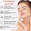 4EMS МИКРОТОК ЛИФТИНГ-МАССАЖЕР MEDICA+ SKIN LIFTING 6.0 WHITE гарантия 1 год 2